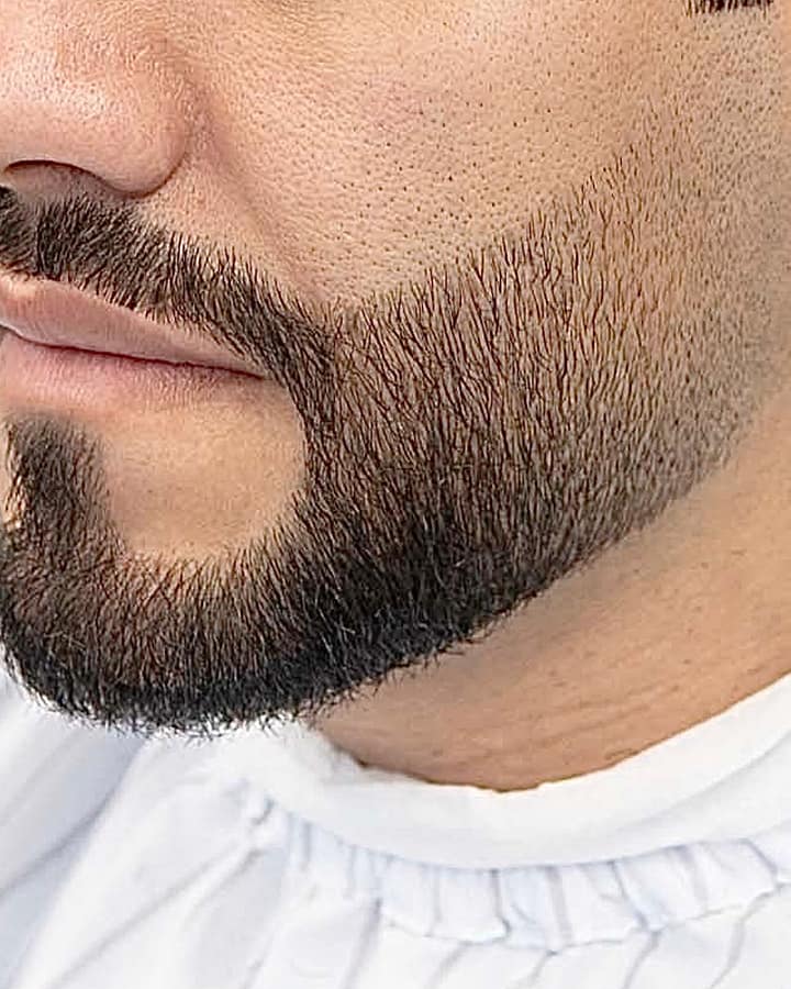 Close view of a finished Italian beard fade with a sharp jawline and cheek line